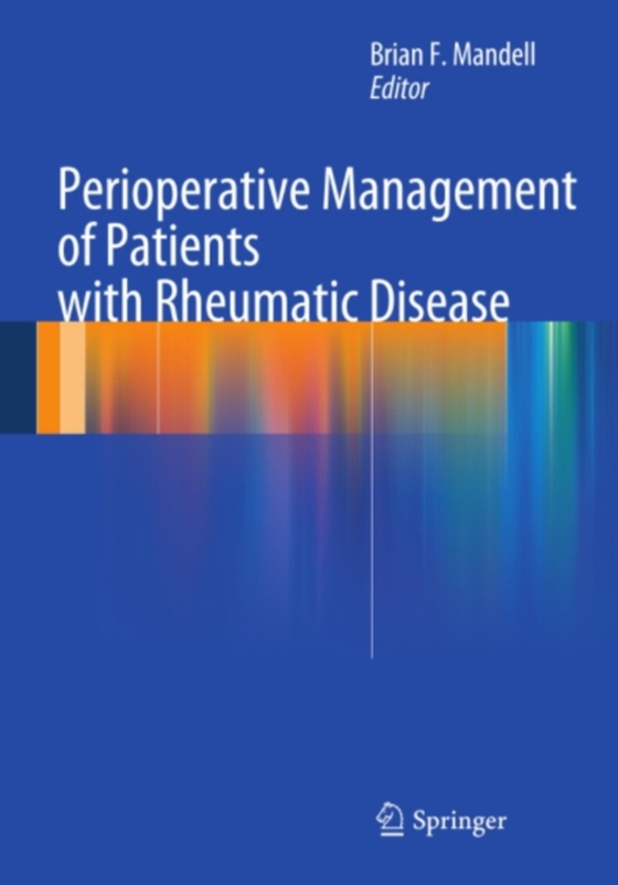 Perioperative Management of Patients with Rheumatic Disease (e-bog) af -