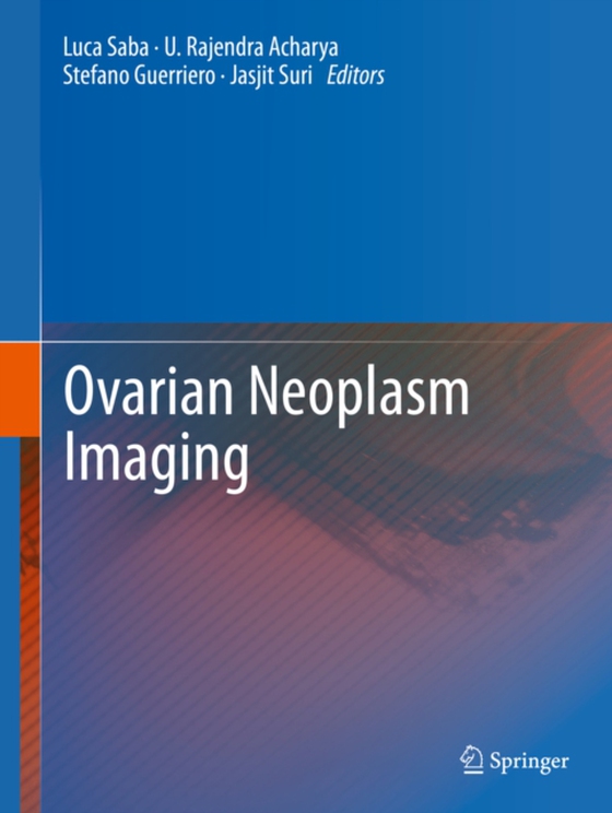 Ovarian Neoplasm Imaging