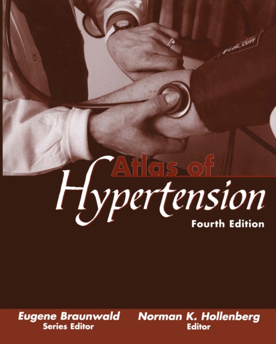 Atlas of Hypertension (e-bog) af -