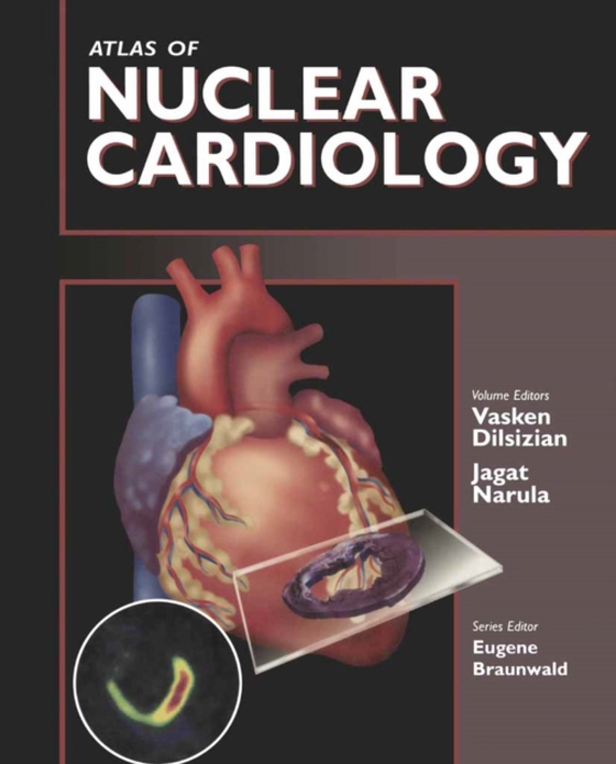 Atlas of Nuclear Cardiology (e-bog) af -