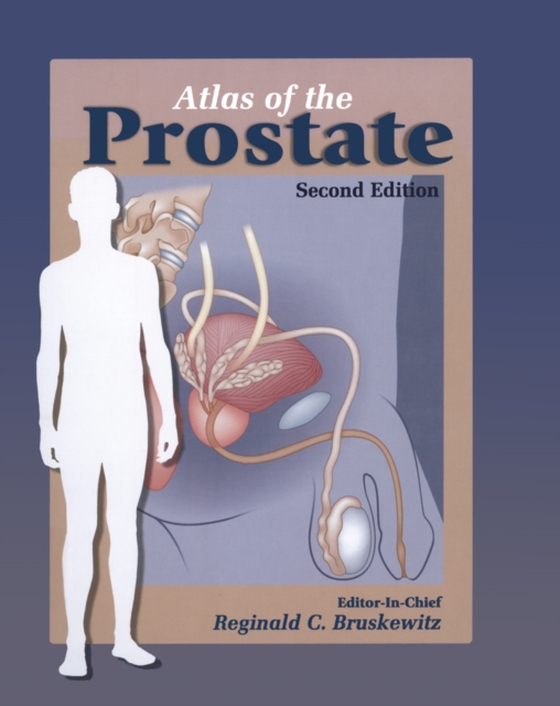 Atlas of the Prostate (e-bog) af -