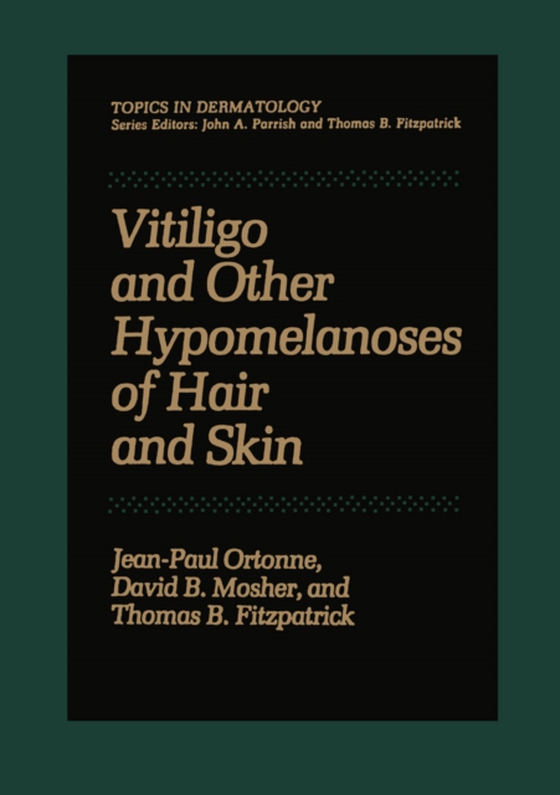 Vitiligo and Other Hypomelanoses of Hair and Skin (e-bog) af Ortonne, Jean-Paul