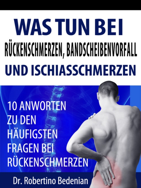 Was Tun Bei Ruckenschmerzen, Bandscheibenvorfall Und Ischiasschmerzen: 10 Antworten Zu Den Haufigsten Fragen Bei Ruckenschmerzen