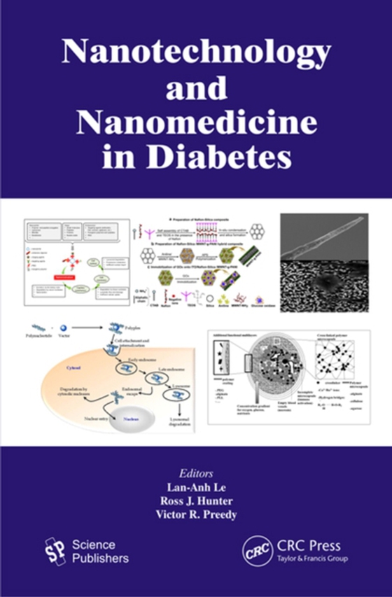 Nanotechnology and Nanomedicine in Diabetes (e-bog) af -