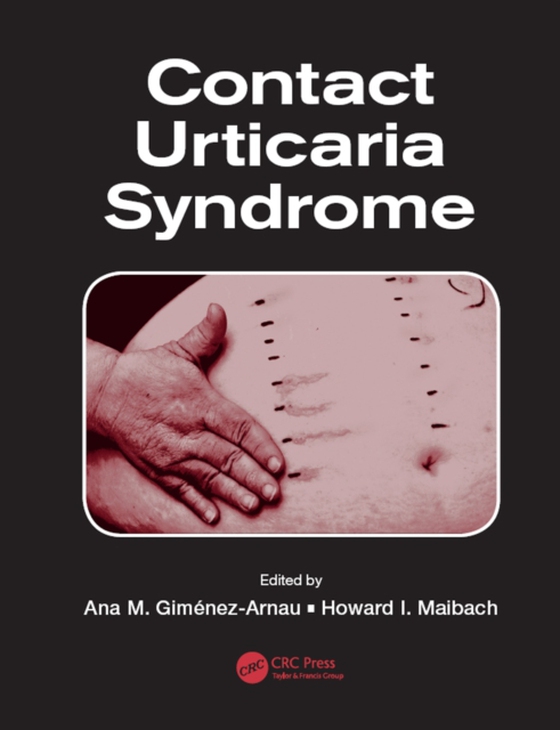 Contact Urticaria Syndrome (e-bog) af -