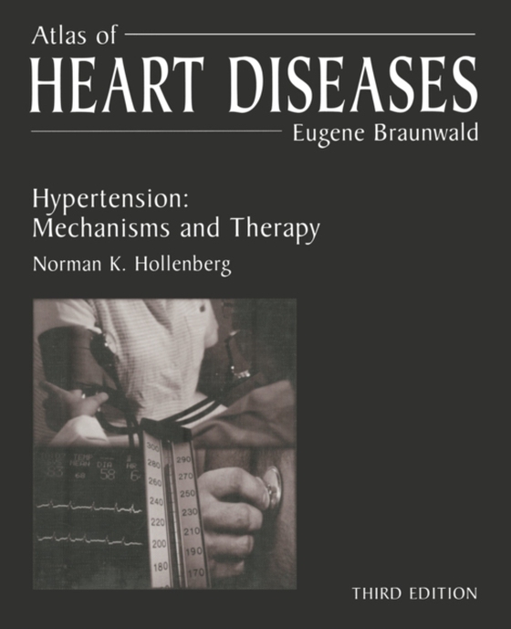 Atlas of Heart Diseases (e-bog) af -