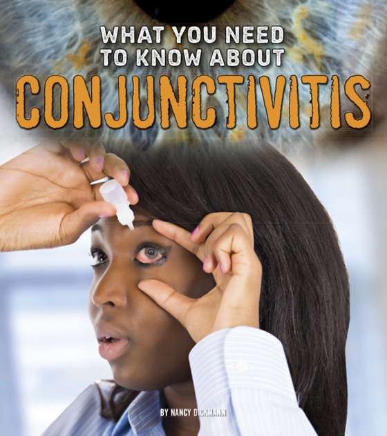 What You Need to Know about Conjunctivitis (e-bog) af Dickmann, Nancy