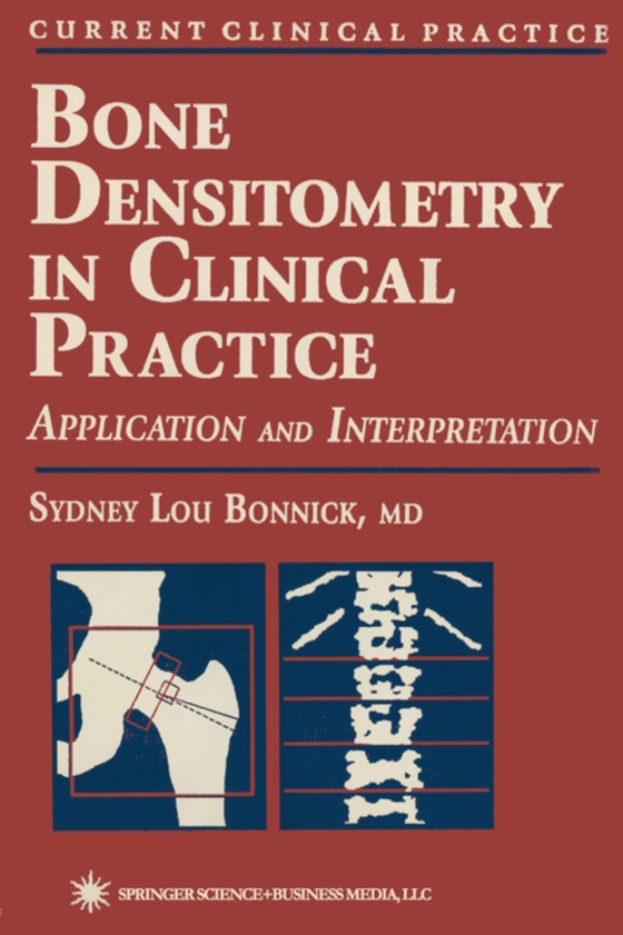 Bone Densitometry in Clinical Practice (e-bog) af Bonnick, Sydney Lou