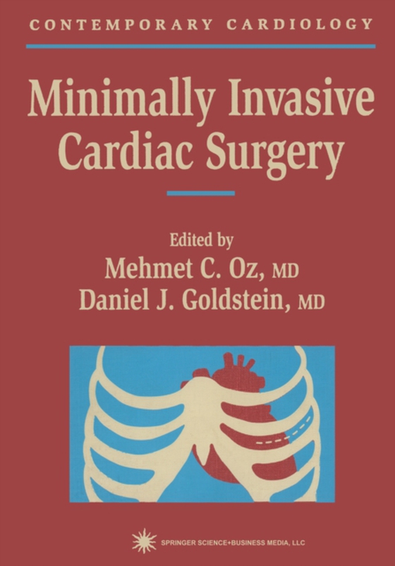 Minimally Invasive Cardiac Surgery (e-bog) af -