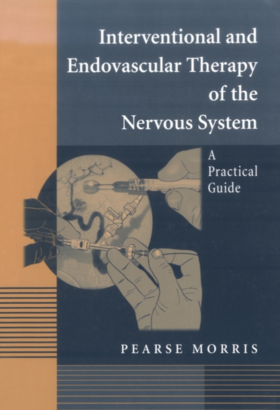 Interventional and Endovascular Therapy of the Nervous System (e-bog) af Morris, Pearse