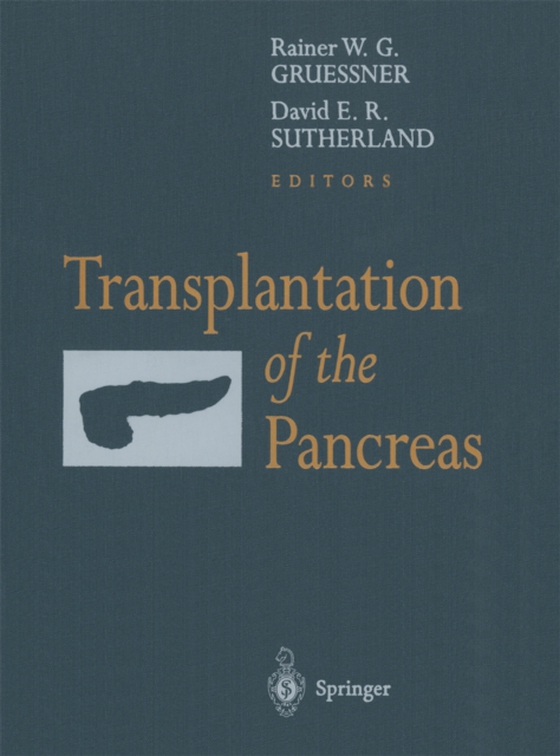 Transplantation of the Pancreas (e-bog) af -