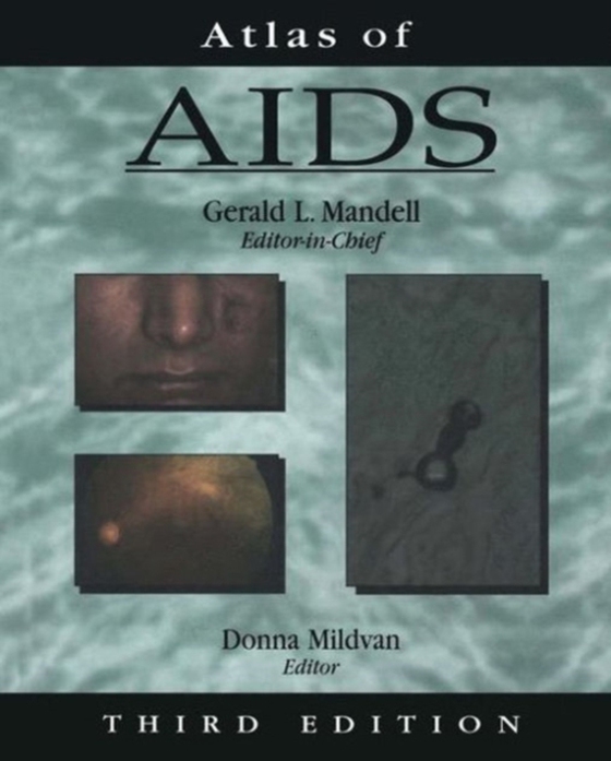 Atlas of AIDS (e-bog) af -