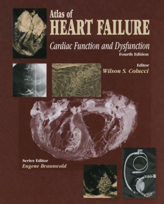 Atlas of HEART FAILURE (e-bog) af -