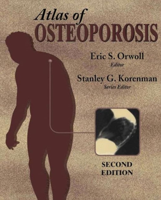 Atlas of Osteoporosis (e-bog) af -