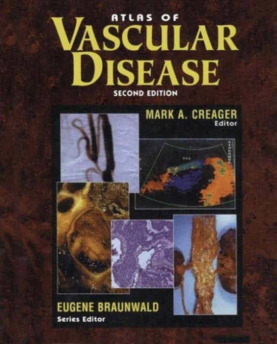 Atlas of Vascular Disease (e-bog) af -