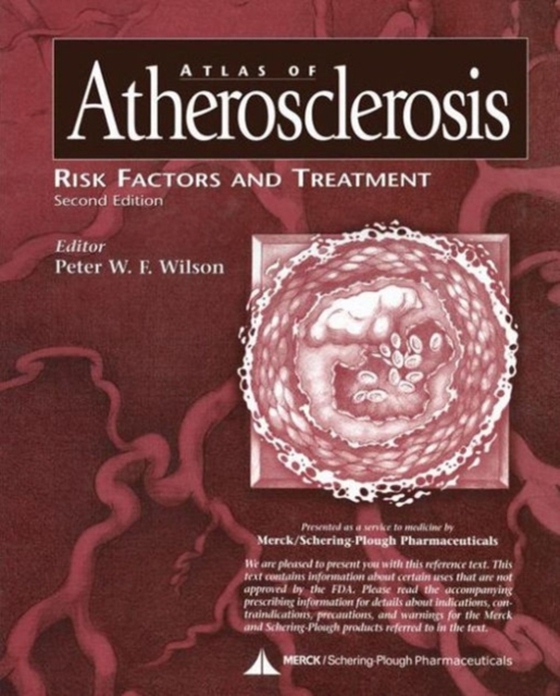 Atlas of Atherosclerosis (e-bog) af -