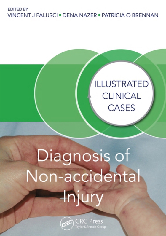 Diagnosis of Non-accidental Injury (e-bog) af -