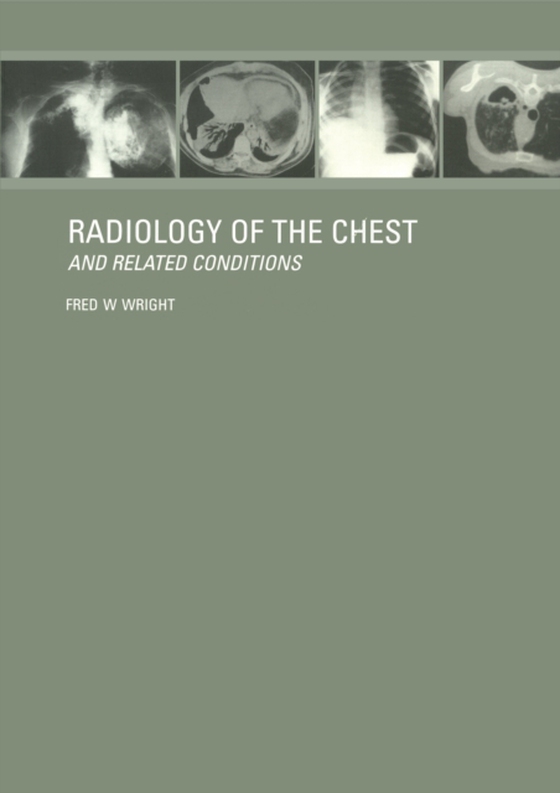 Radiology of the Chest and Related Conditions (e-bog) af Wright, F W