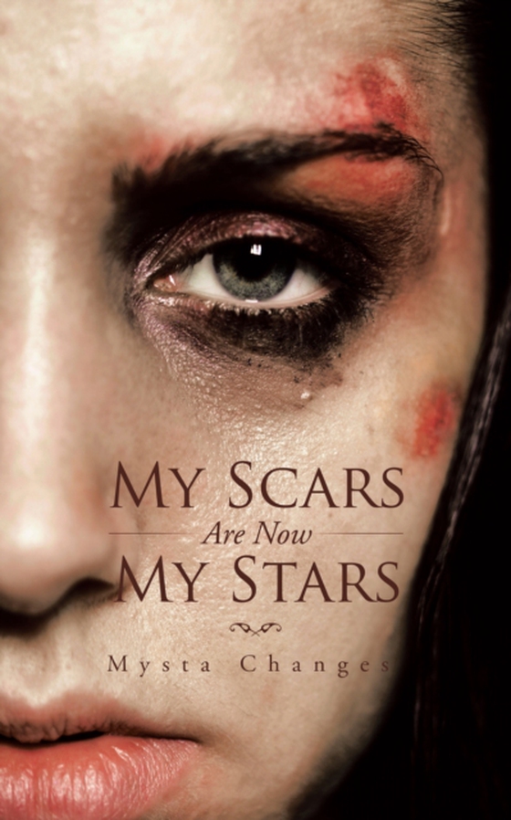 My Scars Are Now My Stars (e-bog) af Changes, Mysta