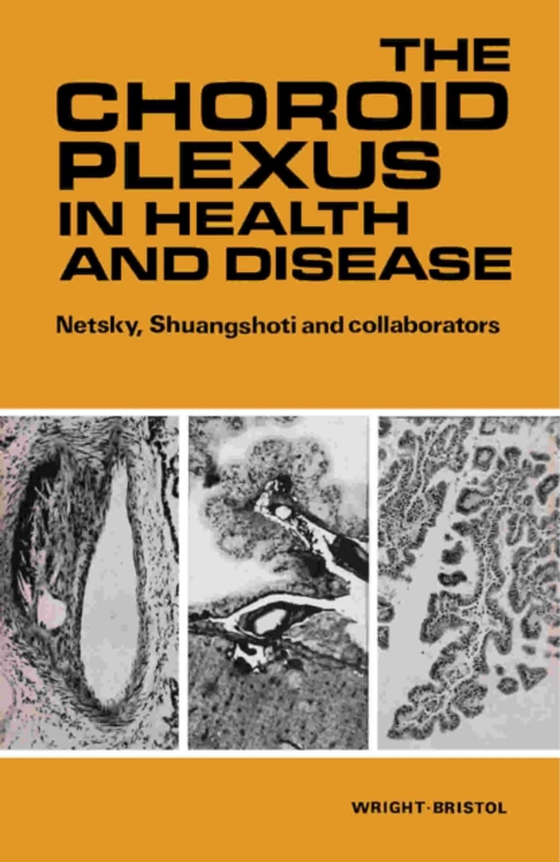 Choroid Plexus in Health and Disease (e-bog) af Shuangshoti, Samruay