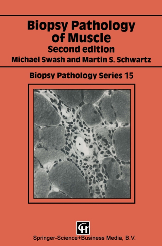 Biopsy Pathology of Muscle (e-bog) af Schwartz, Martin S.