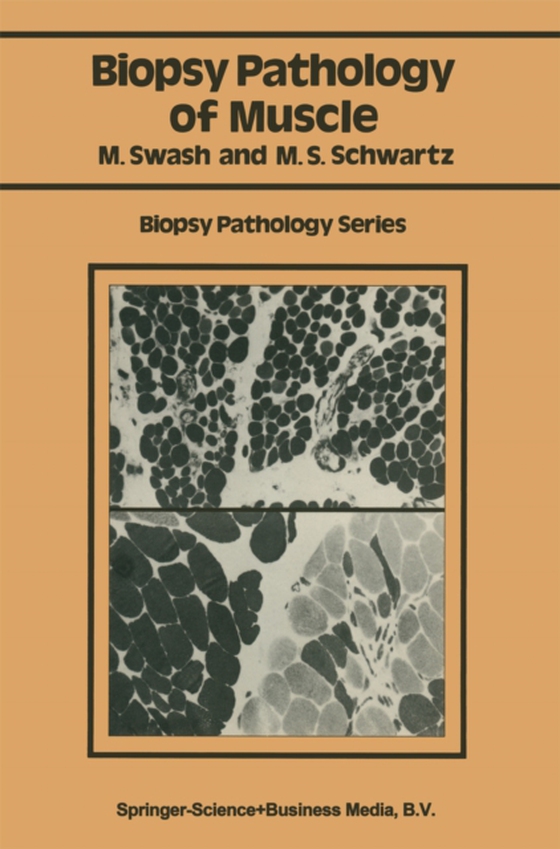 Biopsy pathology of muscle (e-bog) af Schwartz, Martin S.