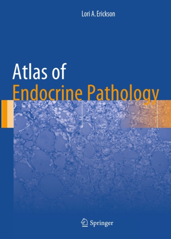 Atlas of Endocrine Pathology (e-bog) af Erickson, Lori A.