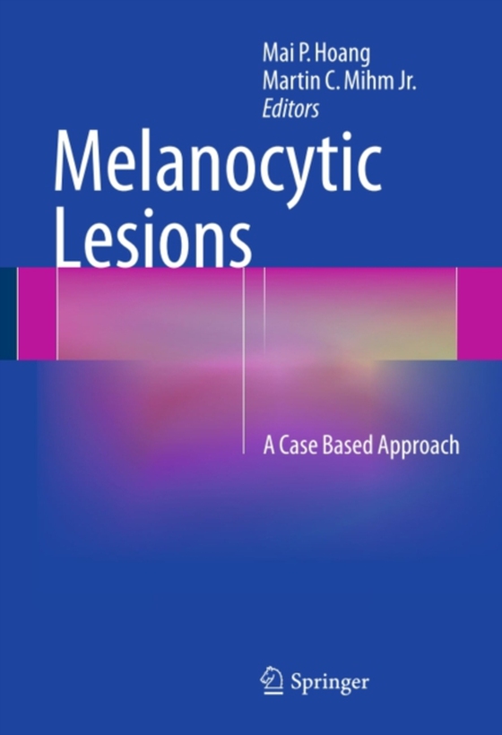 Melanocytic Lesions (e-bog) af -