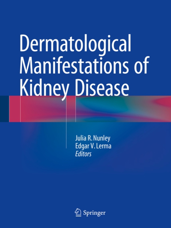 Dermatological Manifestations of Kidney Disease (e-bog) af -