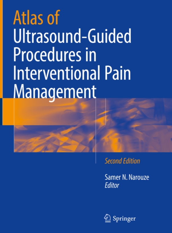 Atlas of Ultrasound-Guided Procedures in Interventional Pain Management (e-bog) af -