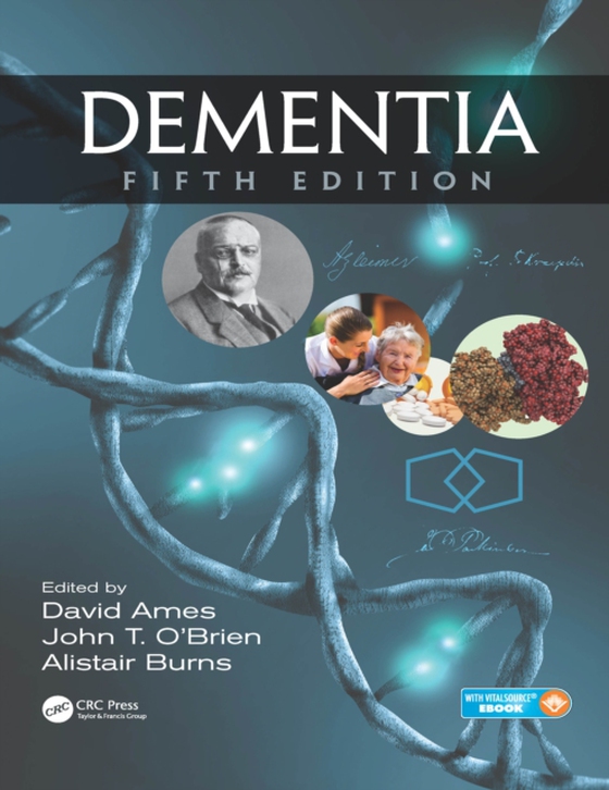 Dementia (e-bog) af -