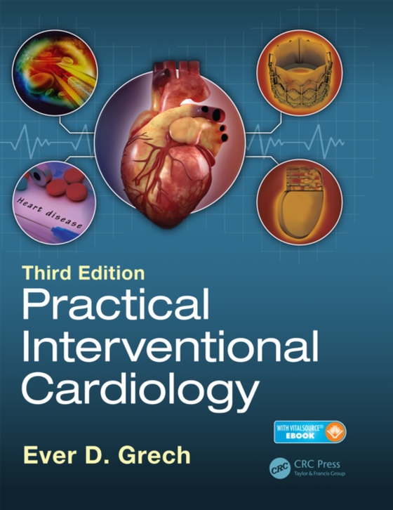 Practical Interventional Cardiology (e-bog) af -