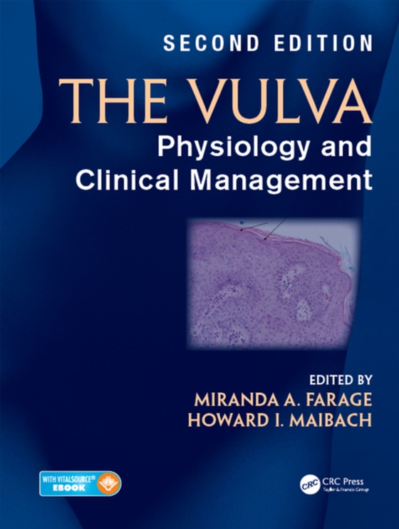 Vulva