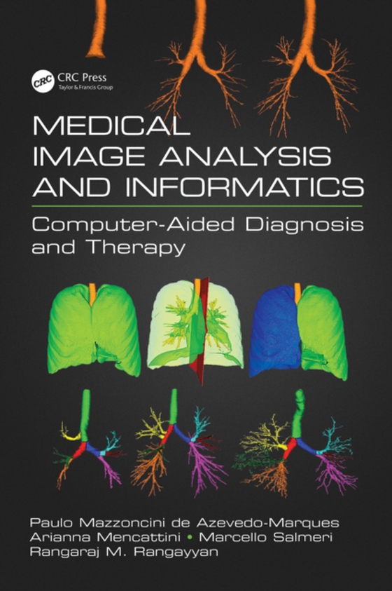 Medical Image Analysis and Informatics (e-bog) af -