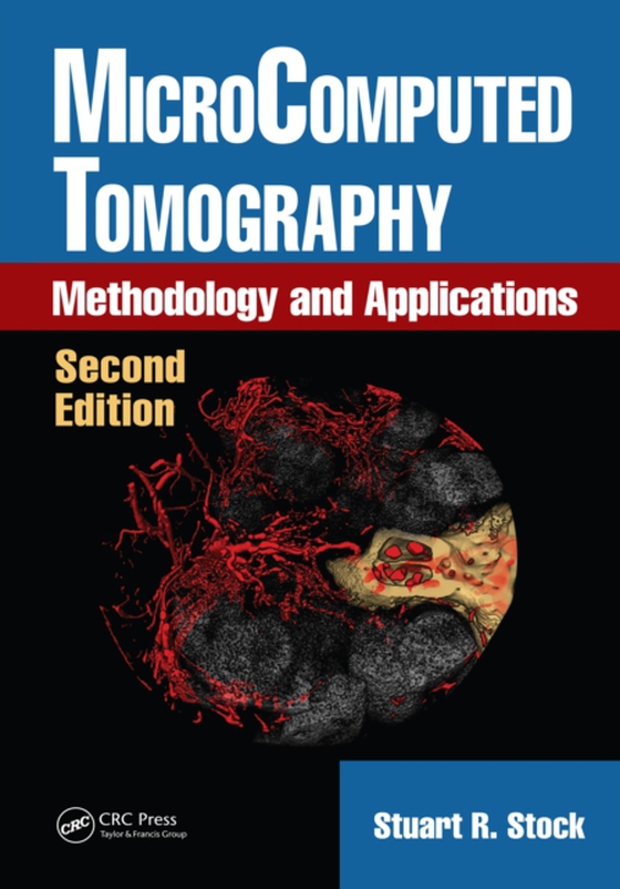 MicroComputed Tomography (e-bog) af Stock, Stuart R.