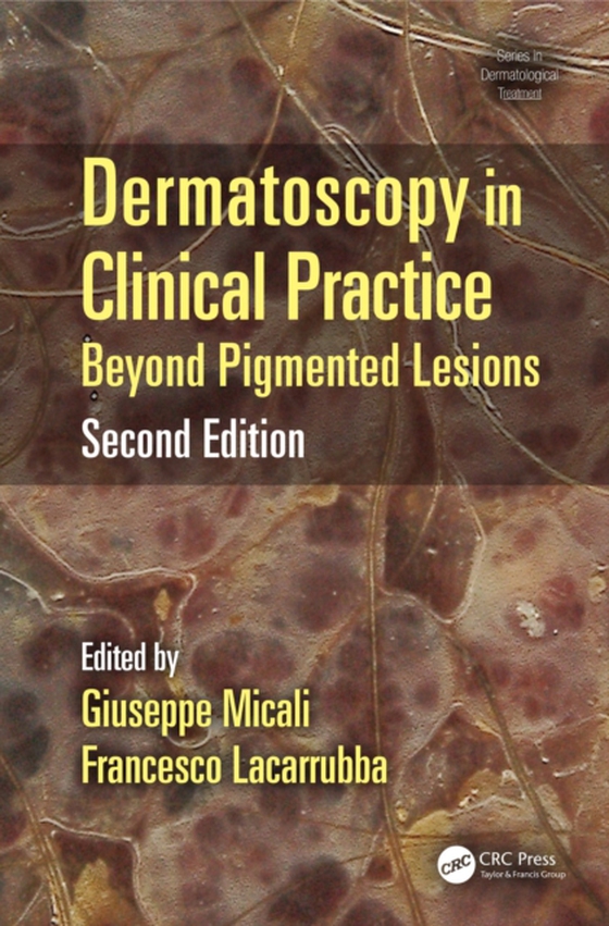 Dermatoscopy in Clinical Practice (e-bog) af -