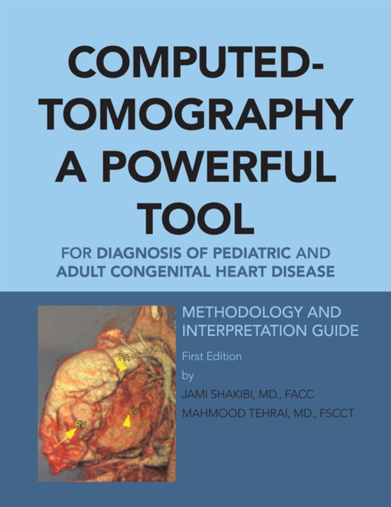 Computed-Tomography a Powerful Tool for Diagnosis of Pediatric and Adult Congenital Heart Disease (e-bog) af Shakibi, Jami G.