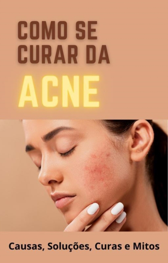 Como se curar da Acne 