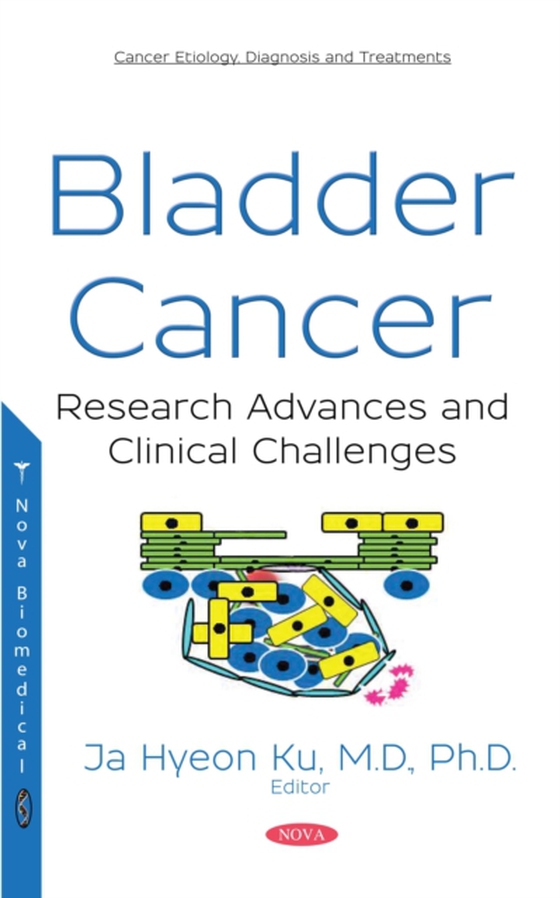 Bladder Cancer: Research Advances and Clinical Challenges