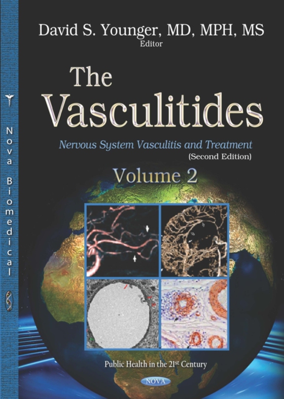 Vasculitides. Volume 2: Nervous System Vasculitis and Treatment (Second Edition) (e-bog) af -