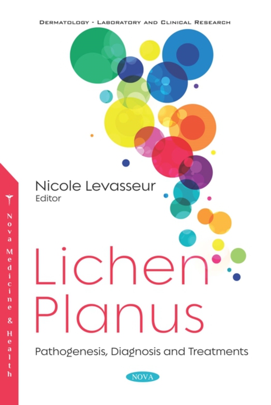 Lichen Planus: Pathogenesis, Diagnosis and Treatments (e-bog) af -