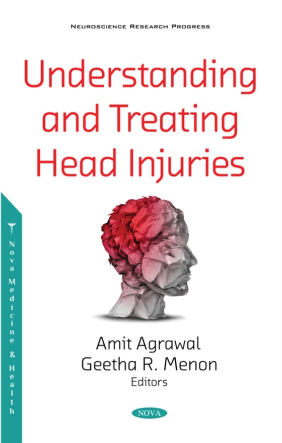 Understanding and Treating Head Injuries (e-bog) af -