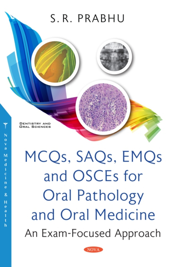 MCQs, SAQs, EMQs and OSCEs for Oral Pathology and Oral Medicine: An Exam-Focused Approach (e-bog) af -