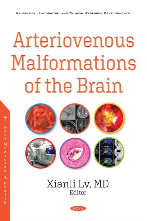 Arteriovenous Malformations of the Brain (e-bog) af -