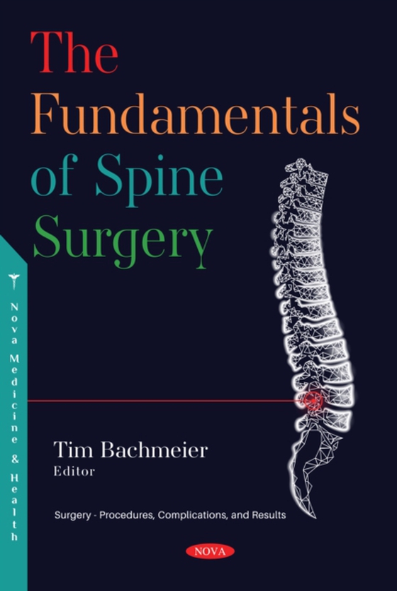 Fundamentals of Spine Surgery (e-bog) af -