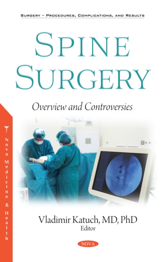 Spine Surgery: Overview and Controversies (e-bog) af -