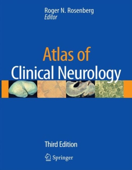 Atlas of Clinical Neurology (e-bog) af -