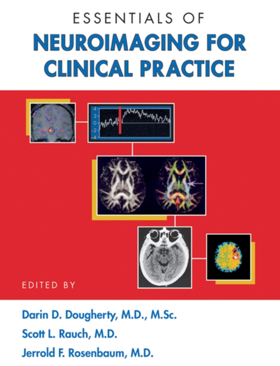 Essentials of Neuroimaging for Clinical Practice (e-bog) af -