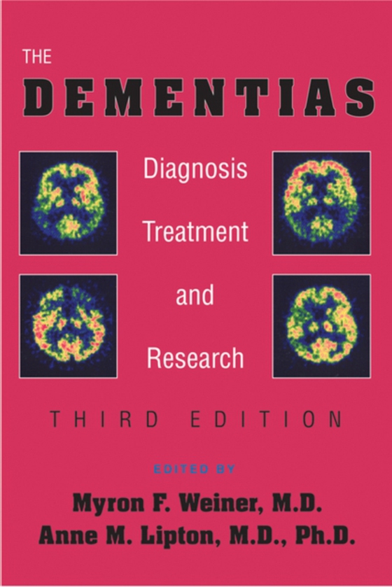 Dementias (e-bog) af -