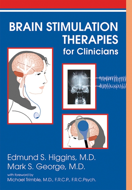 Brain Stimulation Therapies for Clinicians (e-bog) af George, Mark S.